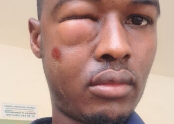 Hôpital national Donka : accidenté, Oumar Sylla Bah raconte sa mésaventure