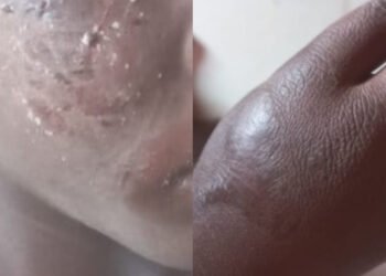 Mamou : Ousmane Barry violemment frappé par son père à Fello-Bantan 3