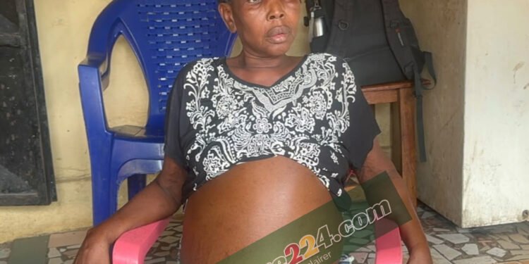 SOS pour M’mah Kaba, âgée d’une quarantaine d’années, domiciliée à Matoto Khabitaya